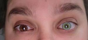 green contact lenses